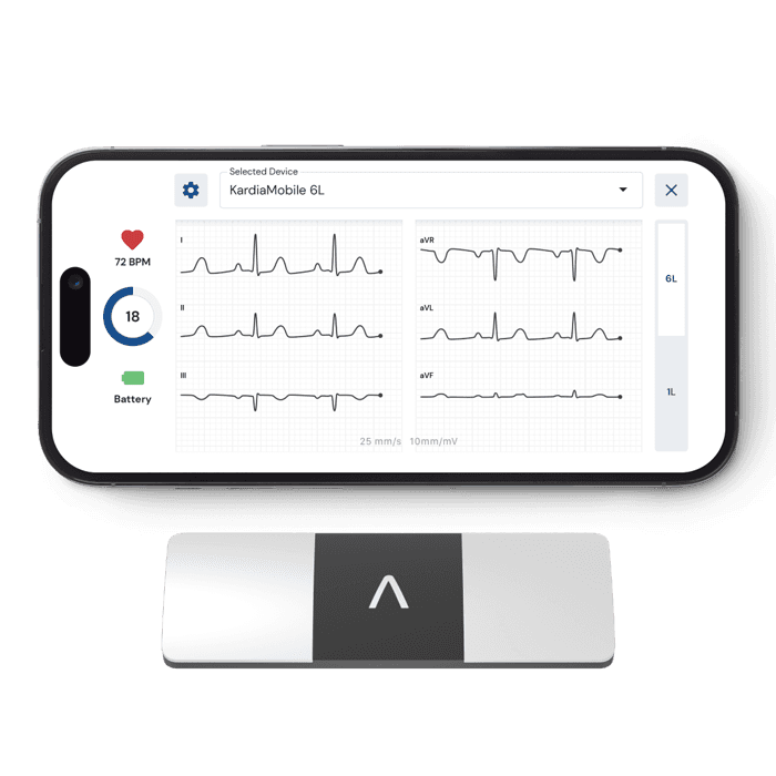 Kardia Device